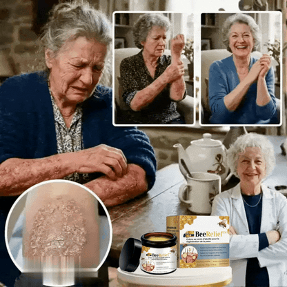 BeeRelief™ crème de soin pour la peau | Soulage le psoriasis et les irritations cutanées en seulement 30 minutes!